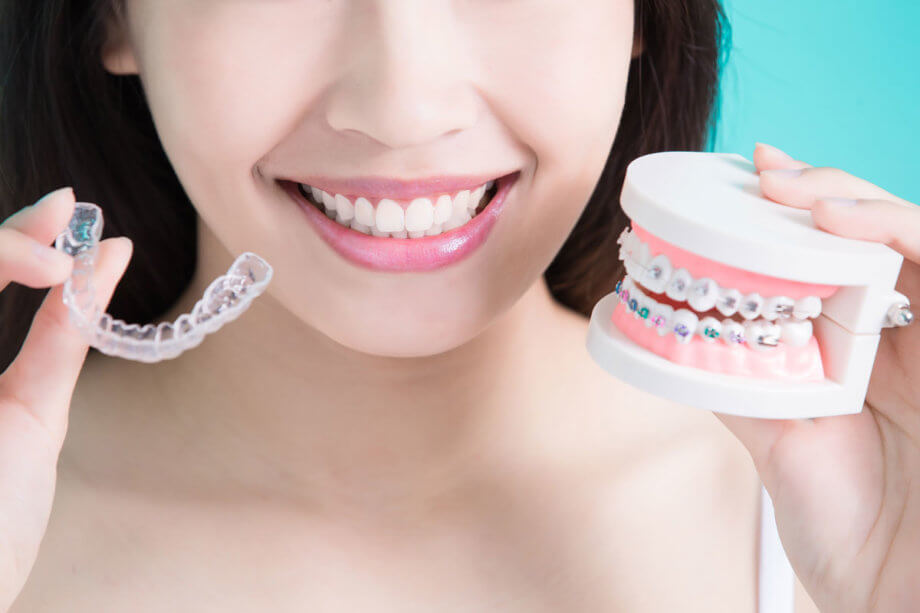 4 Benefits of Invisalign Over Traditional Braces