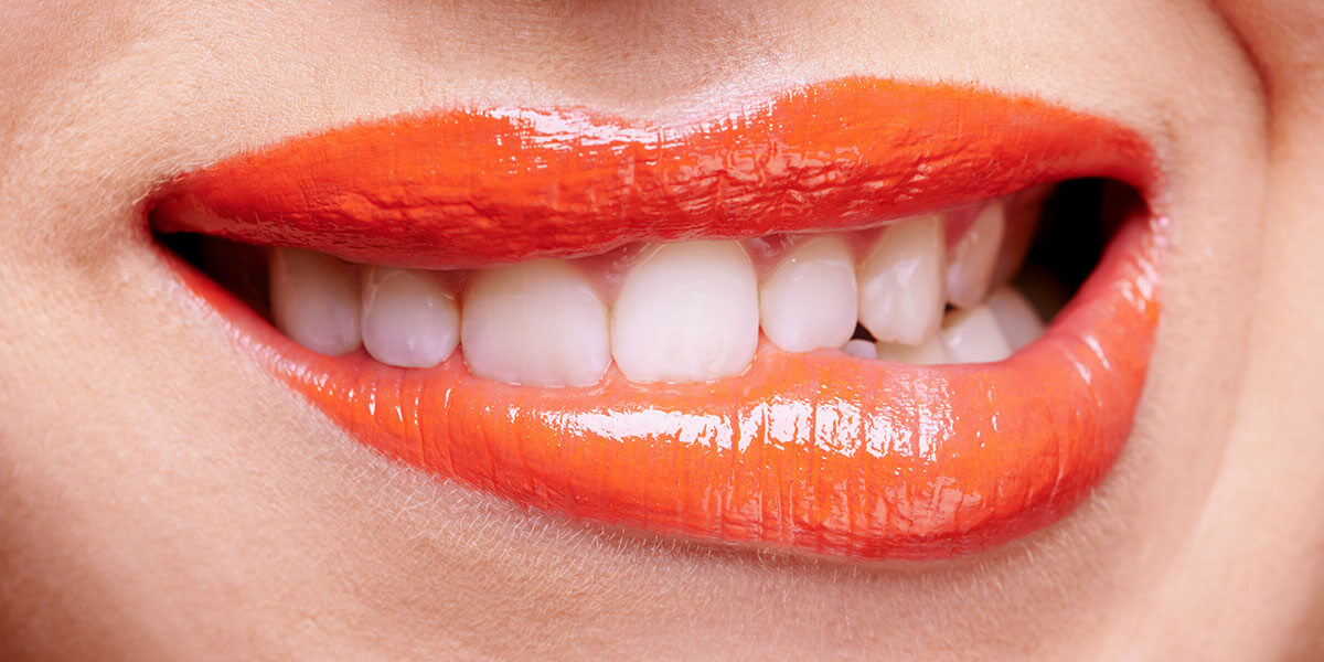Teeth Whitening